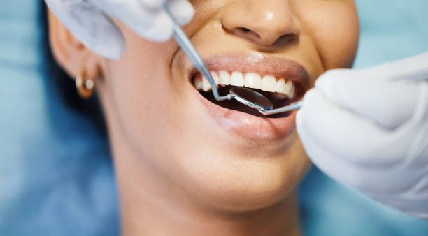 Best Emergency Wisdom Teeth Removal in Honaker, VA